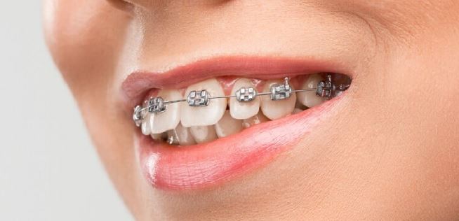 Tratamento ortodôntico