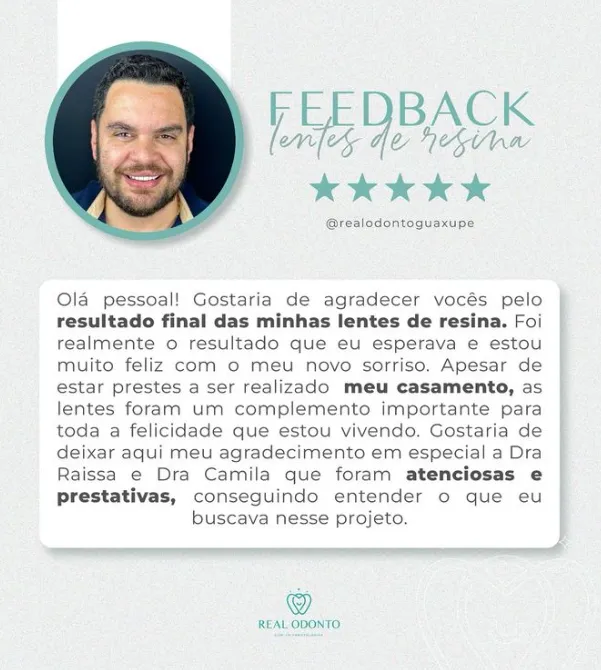 Clareamento dental na Real Odonto